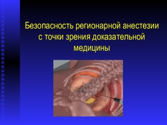 Безопасность регионарной анестезии с точки зрения доказательной медицины