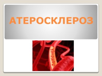 Атеросклероз. Лечение