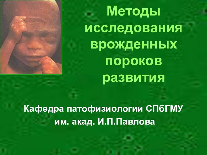 Методы исследования врожденных пороков развитияКафедра патофизиологии СПбГМУ им. акад. И.П.Павлова