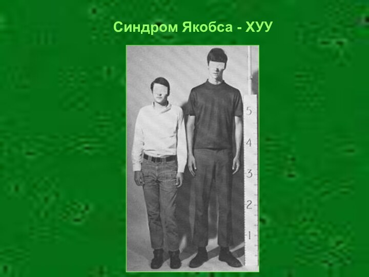 Синдром Якобса - ХУУ