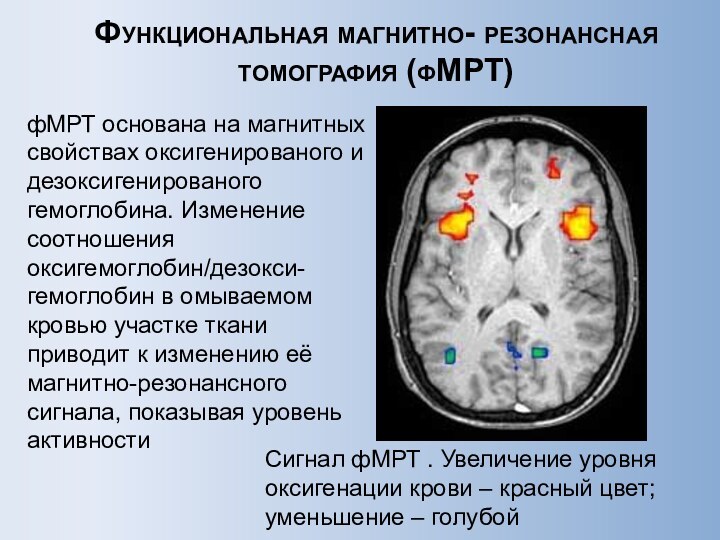 Функциональная магнитно- резонансная томография (фМРТ)фМРТ основана на магнитных свойствах оксигенированого и дезоксигенированого