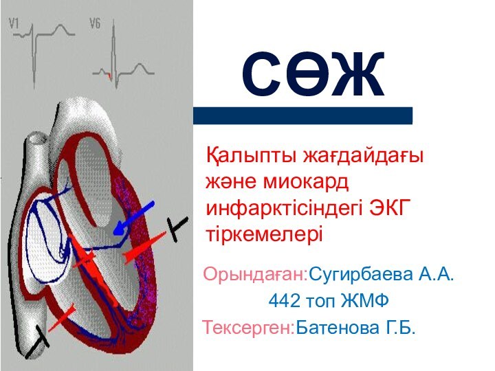 Орындаған:Сугирбаева А.А.442 топ ЖМФТексерген:Батенова Г.Б.СӨЖҚалыпты жағдайдағы және миокард инфарктісіндегі ЭКГ тіркемелері
