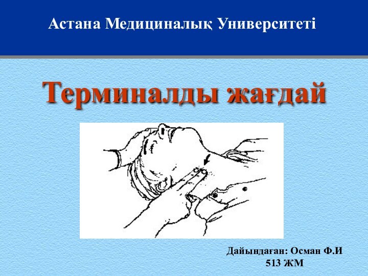 Терминалды жағдай Астана Медициналық УниверситетіДайындаған: Осман Ф.И513 ЖМ