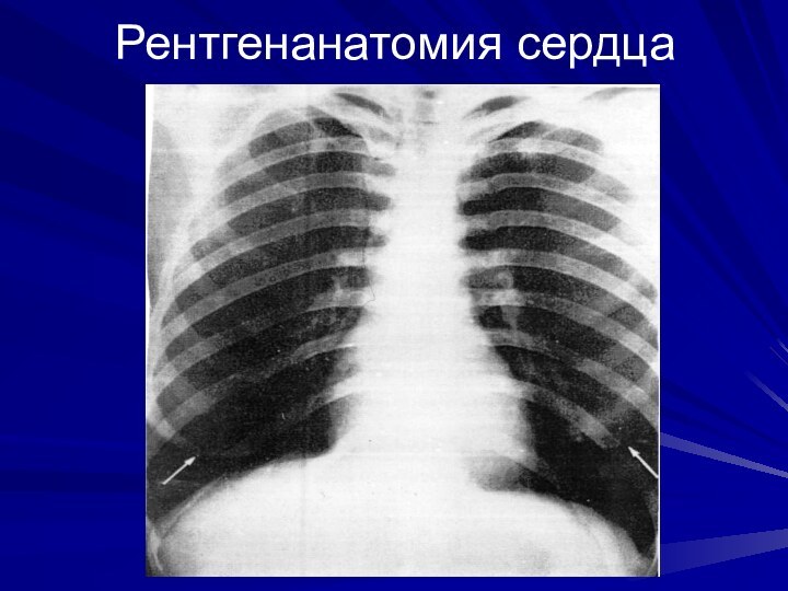 Рентгенанатомия сердца