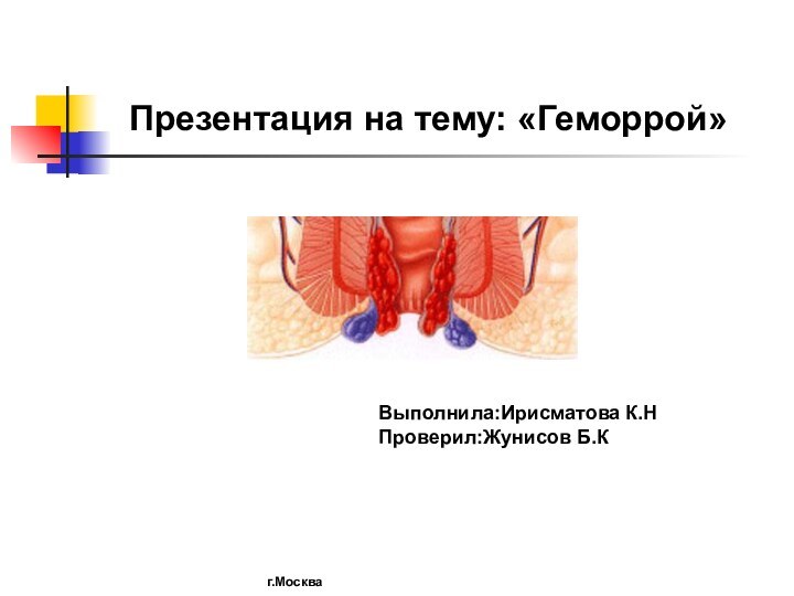 Презентация на тему: «Геморрой»