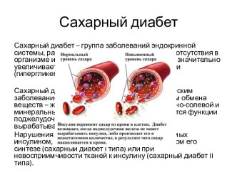 Сахарный диабет