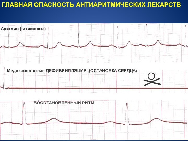 ГЛАВНАЯ ОПАСНОСТЬ АНТИАРИТМИЧЕСКИХ ЛЕКАРСТВ