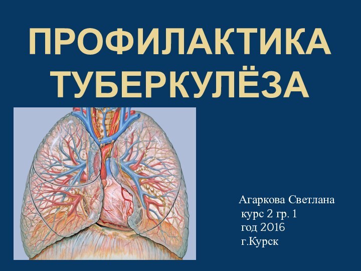 ПРОФИЛАКТИКА ТУБЕРКУЛЁЗААгаркова Светлана   курс 2 гр. 1   год