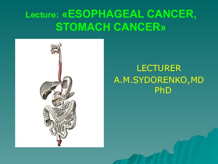 Lecture: «ESOPHAGEAL CANCER, STOMACH CANCER»LECTURERA.M.SYDORENKO,MD PhD