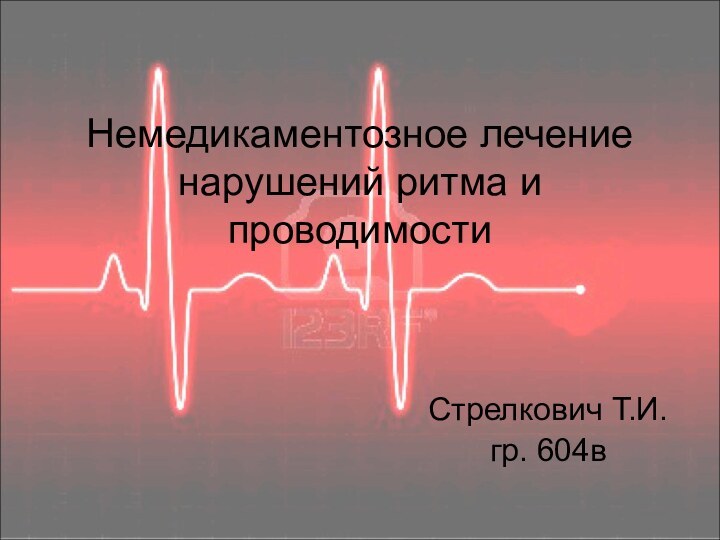 Немедикаментозное лечение нарушений ритма и проводимостиСтрелкович Т.И.гр. 604в