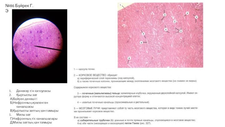 №86 Бүйрек Г.ЭДәнекер тін капсуласыҚыртысты затА)Бүйрек денешігіБ)Нефронның иреленген каналшасыВ)Қыртысты заттың қан тамырыМилы
