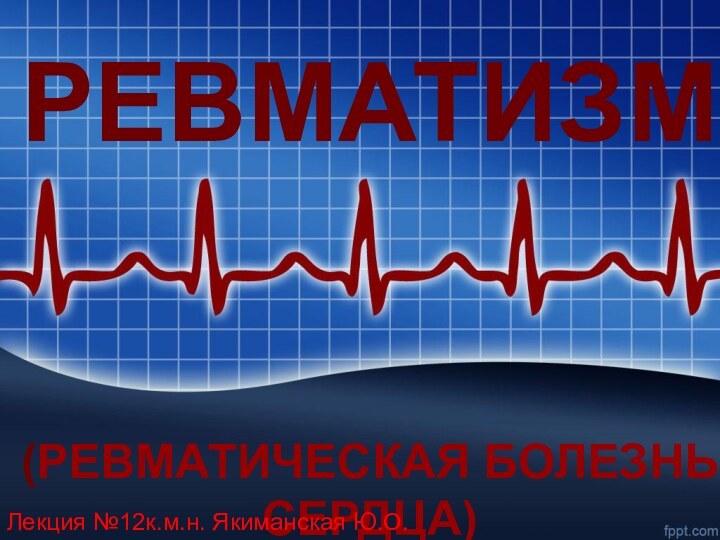 РЕВМАТИЗМ   (РЕВМАТИЧЕСКАЯ БОЛЕЗНЬ СЕРДЦА)  Лекция №12к.м.н. Якиманская Ю.О.