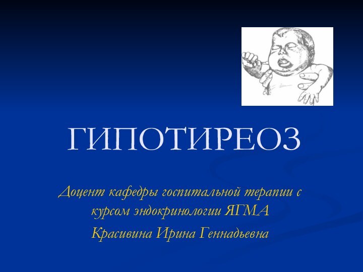 ГИПОТИРЕОЗДоцент кафедры госпитальной терапии с курсом эндокринологии ЯГМАКрасивина Ирина Геннадьевна