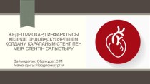 Жедел миокард инфарктысы кезінде эндоваскулярлы ем қолдану. Қарапайым стент пен MEIR стентін салыстыру