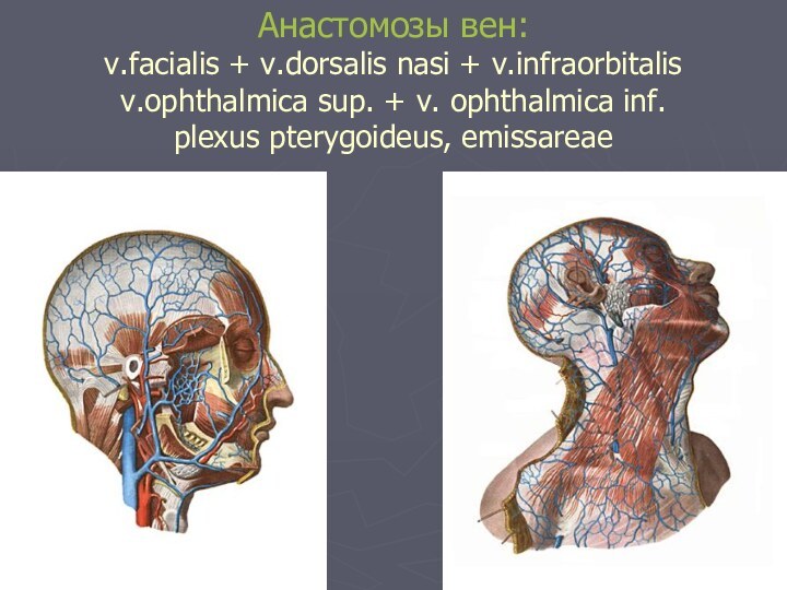 Анастомозы вен: v.facialis + v.dorsalis nasi + v.infraorbitalis v.ophthalmica sup. + v.