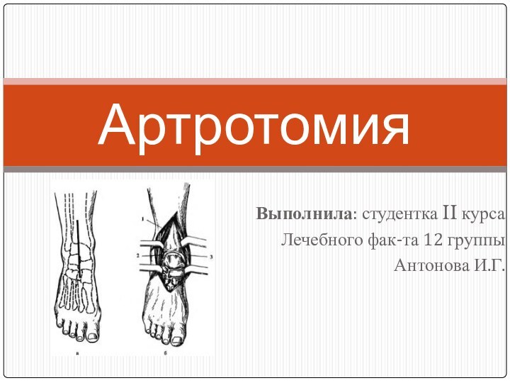 Выполнила: студентка II курсаЛечебного фак-та 12 группыАнтонова И.Г.Артротомия