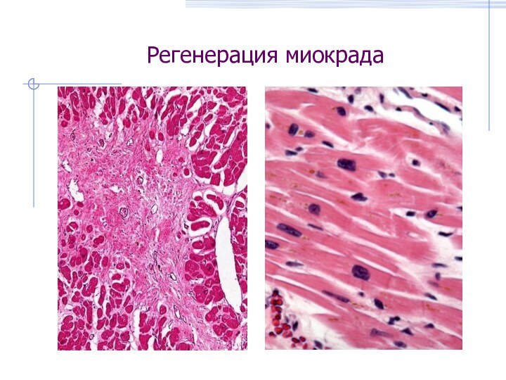 Регенерация миокрада