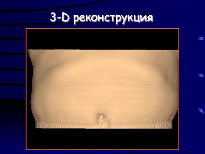 3-D реконструкция