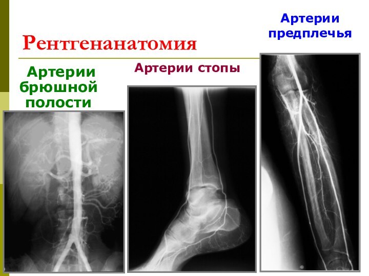 Рентгенанатомия  Артерии брюшной полостиАртерии стопыАртерии предплечья