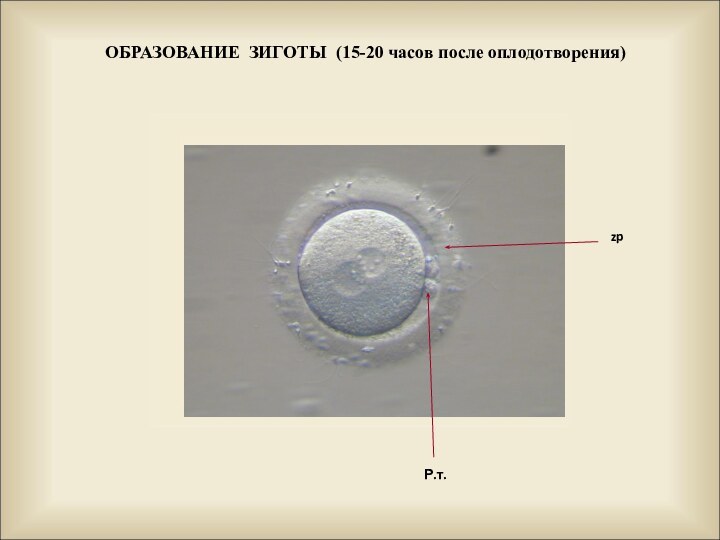 ОБРАЗОВАНИЕ ЗИГОТЫ (15-20 часов после оплодотворения) Р.т.zp