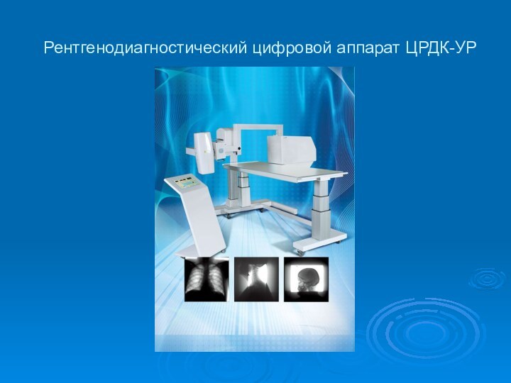 Рентгенодиагностический цифровой аппарат ЦРДК-УР