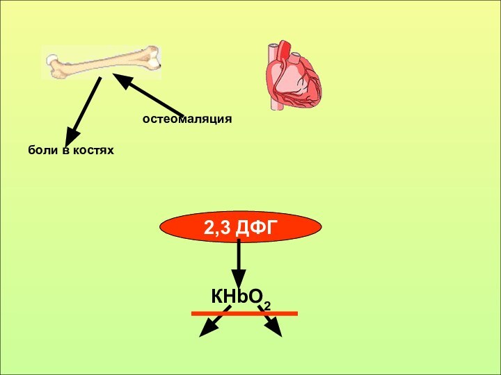 боли в костяхостеомаляция2,3 ДФГКНbO2