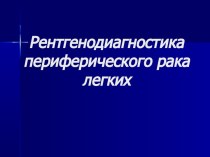 Рентгенодиагностика периферического рака легких