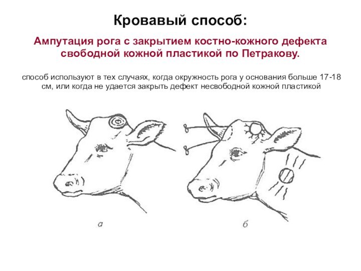 Кровавый способ:Ампутация рога с закрытием костно-кожного дефекта свободной кожной пластикой по Петракову.способ