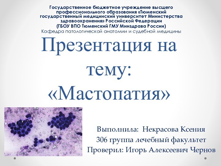 Презентация на тему: «Мастопатия»Государственное бюджетное учреждение высшего профессионального образования «Тюменский государственный медицинский