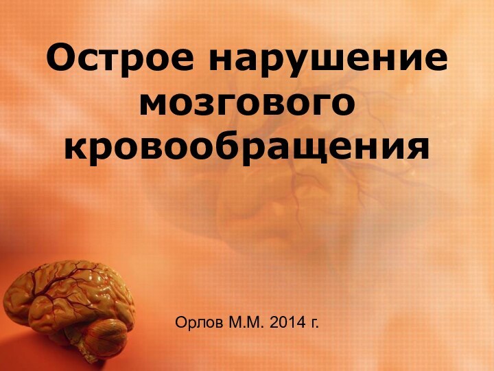 Острое нарушение мозгового кровообращенияОрлов М.М. 2014 г.