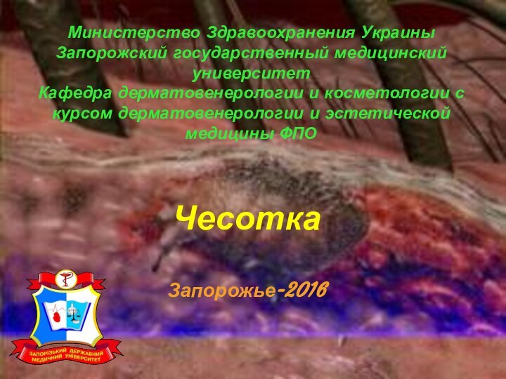 Министерство Здравоохранения УкраиныЗапорожский государственный медицинский университетКафедра дерматовенерологии и косметологии с курсом дерматовенерологии