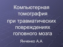 Компьютерная томография при травматических повреждениях головного мозга