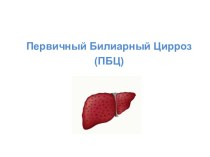 Первичный билиарный цирроз