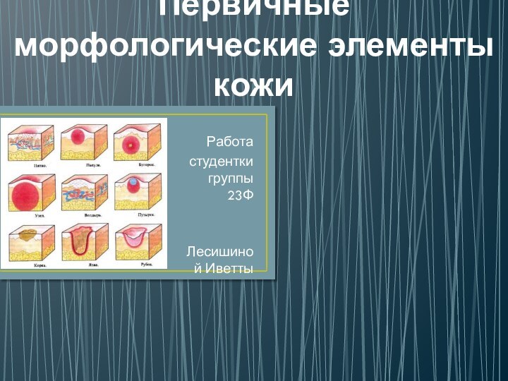 Первичные морфологические элементы кожиРабота студентки группы 23Ф Лесишиной Иветты