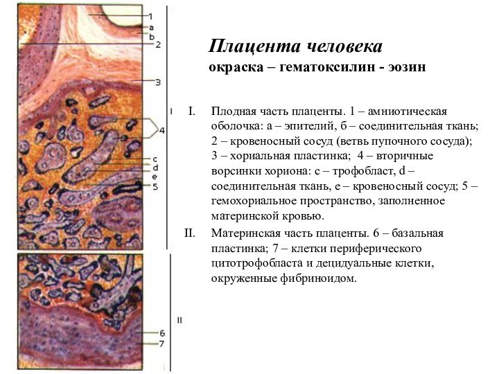 Плацента человека 	окраска – гематоксилин - эозин Плодная часть плаценты. 1 –