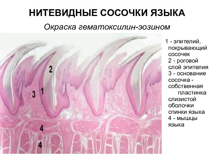 НИТЕВИДНЫЕ СОСОЧКИ ЯЗЫКА  Окраска гематоксилин-эозином  1 - эпителий, покрывающий сосочек