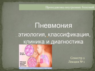 Пневмония этиология, классификация, клиника и диагностика