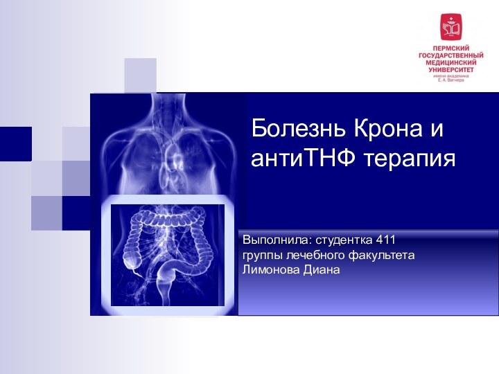 Болезнь Крона и антиТНФ терапияВыполнила: студентка 411 группы лечебного факультета Лимонова Диана