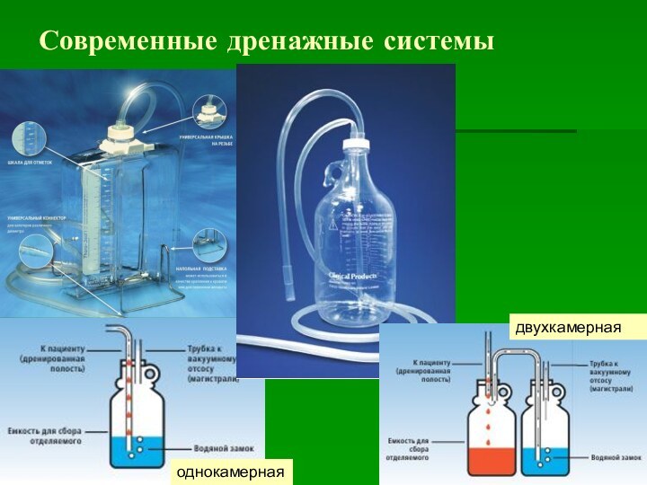 Современные дренажные системыоднокамернаядвухкамерная