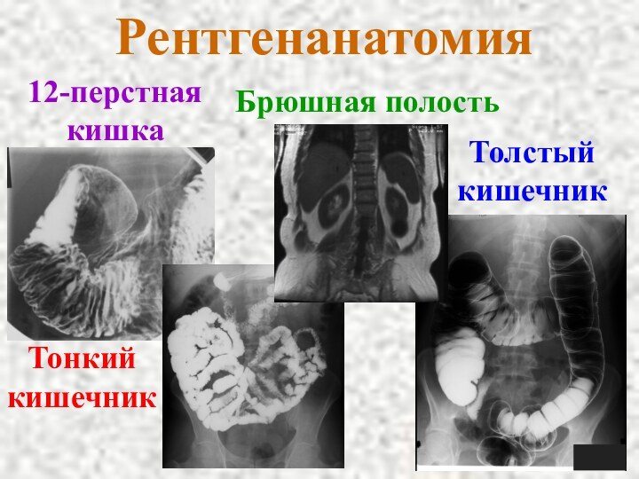 Рентгенанатомия12-перстнаякишкаБрюшная полостьТонкий кишечникТолстыйкишечник