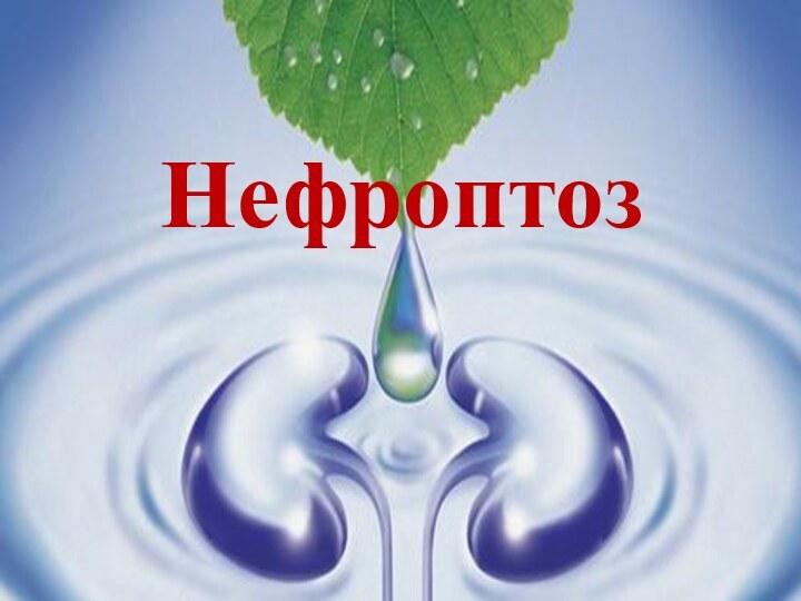 Нефроптоз