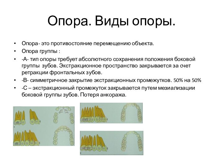 Опора. Виды опоры.Опора- это противостояние перемещению объекта.Опора группы :-А- тип опоры требует