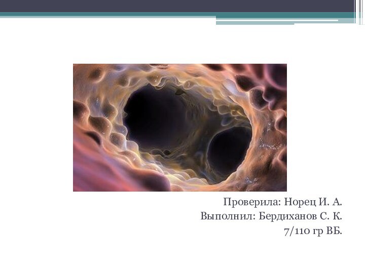 Саркоидоз легкихПроверила: Норец И. А.Выполнил: Бердиханов С. К.7/110 гр ВБ.