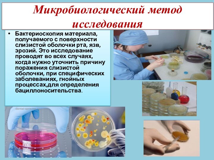 Микробиологический метод исследованияБактериоскопия материала, получаемого с поверхности слизистой оболочки рта, язв, эрозий.