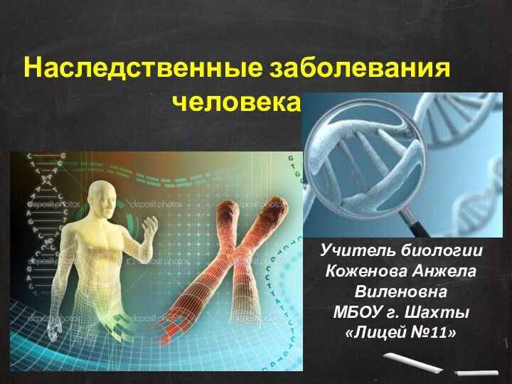 Учитель биологии Коженова Анжела ВиленовнаМБОУ г. Шахты «Лицей №11»Наследственные заболевания человека