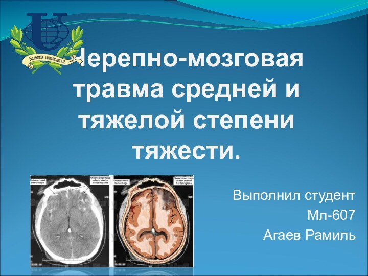 Черепно-мозговая травма средней и тяжелой степени тяжести. Выполнил студентМл-607Агаев Рамиль