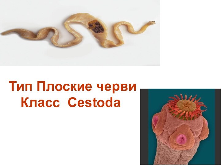 Тип Плоские черви Класс Cestoda