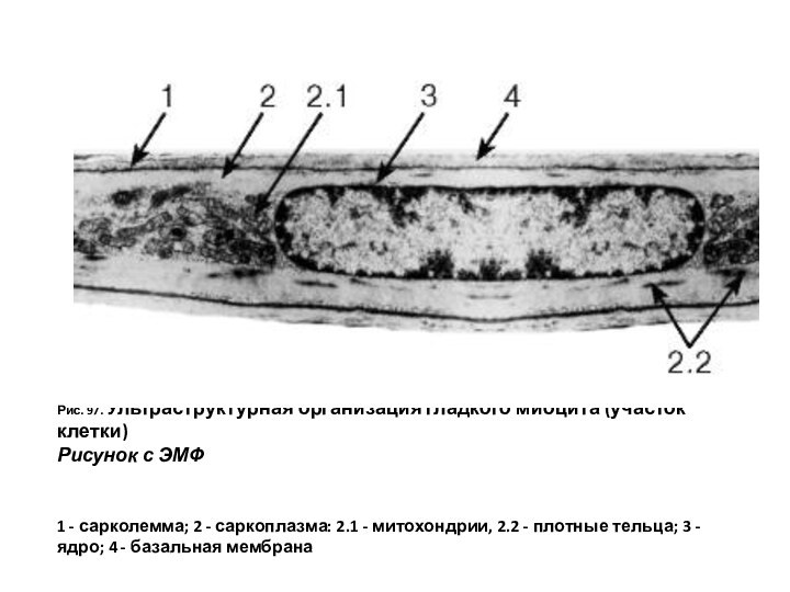 Рис. 97. Ультраструктурная организация гладкого миоцита (участок клетки) Рисунок с ЭМФ 1