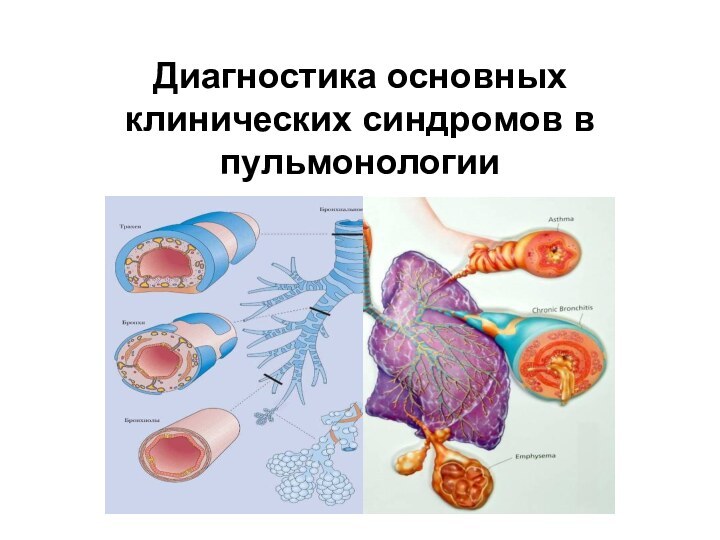 Диагностика основных клинических синдромов в пульмонологии