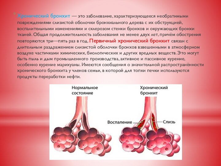 Хронический бронхит — это заболевание, характеризующееся необратимыми повреждениями слизистой оболочки бронхиального дерева